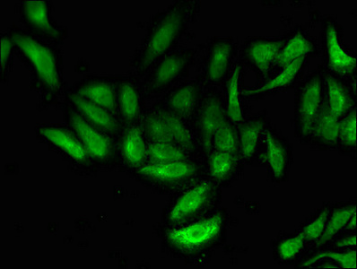 TNP1 / TP1 Antibody - Immunofluorescent analysis of Hela cells using TNP1 Antibody at dilution of 1:100 and Alexa Fluor 488-congugated AffiniPure Goat Anti-Rabbit IgG(H+L)