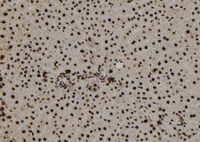 TNP1 / TP1 Antibody - 1:100 staining rat liver tissue by IHC-P. The sample was formaldehyde fixed and a heat mediated antigen retrieval step in citrate buffer was performed. The sample was then blocked and incubated with the antibody for 1.5 hours at 22°C. An HRP conjugated goat anti-rabbit antibody was used as the secondary.