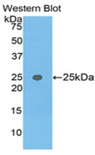 TNPO1 / Transportin 1 Antibody - Western blot of recombinant TNPO1 / Transportin 1.  This image was taken for the unconjugated form of this product. Other forms have not been tested.