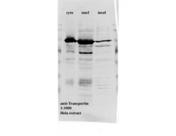 TNPO1 / Transportin 1 Antibody - Western blot of TNPO1 / Transportin 1 antibody.