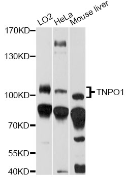 TNPO1 / Transportin 1 Antibody - Western blot analysis of extracts of various cell lines, using TNPO1 antibody at 1:1000 dilution. The secondary antibody used was an HRP Goat Anti-Rabbit IgG (H+L) at 1:10000 dilution. Lysates were loaded 25ug per lane and 3% nonfat dry milk in TBST was used for blocking. An ECL Kit was used for detection and the exposure time was 5s.