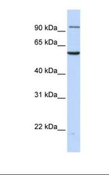 TNPO2 / Importin Antibody - MCF7 cell lysate. Antibody concentration: 1.0 ug/ml. Gel concentration: 12%.  This image was taken for the unconjugated form of this product. Other forms have not been tested.