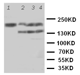 TNR / Tenascin R Antibody - WB of TNR / Tenascin R antibody. Lane 1: Rat Brain Tissue Lysate. Lane 2: U87 Cell Lysate. Lane 3: HELA Cell Lysate. Lane 4: MCF-7 Cell Lysate.