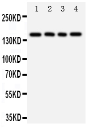 TNR / Tenascin R Antibody - Anti-TNR antibody, Western blotting All lanes: Anti TNR at 0.5ug/ml Lane 1: Rat Brain Tissue Lysate at 50ug Lane 2: U87 Whole Cell Lysate at 40ug Lane 3: HELA Whole Cell Lysate at 40ug Lane 4: MCF-7 Whole Cell Lysate at 40ug Predicted bind size: 150KD Observed bind size: 150KD