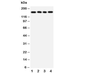 TNR / Tenascin R Antibody - Western blot testing of TNR antibody and Lane 1: rat brain; 2: human U87; 3: (h) HeLa; 4: (h) MCF-7 cell lysate