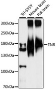 TNR / Tenascin R Antibody - Western blot analysis of extracts of various cell lines, using TNR antibody at 1:1000 dilution. The secondary antibody used was an HRP Goat Anti-Rabbit IgG (H+L) at 1:10000 dilution. Lysates were loaded 25ug per lane and 3% nonfat dry milk in TBST was used for blocking. An ECL Kit was used for detection and the exposure time was 90s.