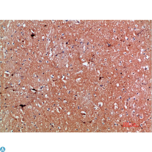 TNR / Tenascin R Antibody - Immunohistochemical analysis of paraffin-embedded human-brain, antibody was diluted at 1:200.