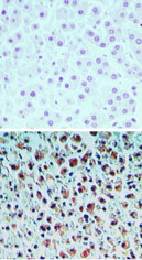 TNRC5 / CNPY3 Antibody - IHC of PRAT4A in formalin-fixed paraffin-embedded human liver tissue using an isotype control antibody (top) and PRATA4 antibody (bottom) at 1:2000.
