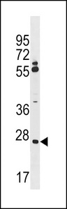 TNRC5 / CNPY3 Antibody - CNPY3 Antibody western blot of A2058 cell line lysates (35 ug/lane). The CNPY3 antibody detected the CNPY3 protein (arrow).