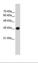 TNRC5 / CNPY3 Antibody - Jurkat Cell Lysate.  This image was taken for the unconjugated form of this product. Other forms have not been tested.