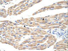 TNRC5 / CNPY3 Antibody - CNPY3 / TNRC5 antibody ARP34422_P050-NP_006577-TNRC5(trinucleotide repeat containing 5) Antibody was used in IHC to stain formalin-fixed, paraffin-embedded human muscle.  This image was taken for the unconjugated form of this product. Other forms have not been tested.
