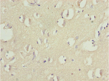 TNRC5 / CNPY3 Antibody - Immunohistochemistry of paraffin-embedded human brain cancer at dilution 1:100