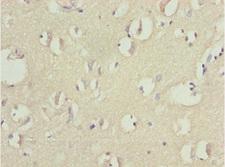 TNRC5 / CNPY3 Antibody - Immunohistochemistry of paraffin-embedded human brain cancer at dilution 1:100