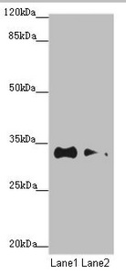 TNRC5 / CNPY3 Antibody - Western blot All Lanes: CNPY3 antibody at 1.2ug/ml Lane 1: HepG-2 whole cell lysate Lane 2: MCF7 whole cell lysate Secondary Goat polyclonal to Rabbit IgG at 1/10000 dilution Predicted band size: 31,6 kDa Observed band size: 31 kDa