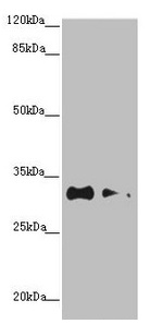 TNRC5 / CNPY3 Antibody - Western blot All lanes: CNPY3 antibody at 1.2µg/ml Lane 1: HepG2 whole cell lysate Lane 2: MCF-7 whole cell lysate Secondary Goat polyclonal to rabbit IgG at 1/10000 dilution Predicted band size: 31, 6 kDa Observed band size: 31 kDa