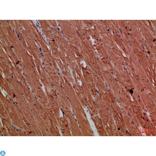 TNRC5 / CNPY3 Antibody - Immunohistochemical analysis of paraffin-embedded Human-skeletal-muscle, antibody was diluted at 1:100.