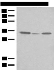 TNRC5 / CNPY3 Antibody - Western blot analysis of OP9 HepG2 and NIH/3T3 cell lysates  using CNPY3 Polyclonal Antibody at dilution of 1:400