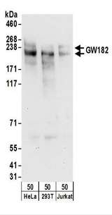 TNRC6A / GW182 Antibody - Detection of Human GW182 by Western Blot. Samples: Whole cell lysate (50 ug) from HeLa, 293T, and Jurkat cells. Antibodies: Affinity purified rabbit anti-GW182 antibody used for WB at 0.1 ug/ml. Detection: Chemiluminescence with an exposure time of 30 seconds.