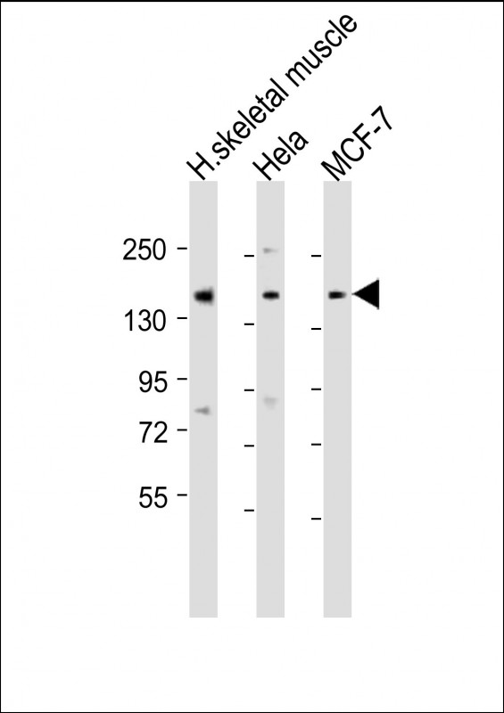 TNRC6A / GW182 Antibody - All lanes: Anti-TNRC6A Antibody (Center) at 1:1000-1:2000 dilution. Lane 1: human skeletal muscle lysate. Lane 2: HeLa whole cell lysate. Lane 3: MCF-7 whole cell lysate Lysates/proteins at 20 ug per lane. Secondary Goat Anti-Rabbit IgG, (H+L), Peroxidase conjugated at 1:10000 dilution. Predicted band size: 210 kDa. Blocking/Dilution buffer: 5% NFDM/TBST.