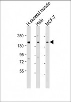 TNRC6A / GW182 Antibody - All lanes: Anti-TNRC6A Antibody (Center) at 1:1000-1:2000 dilution. Lane 1: human skeletal muscle lysate. Lane 2: HeLa whole cell lysate. Lane 3: MCF-7 whole cell lysate Lysates/proteins at 20 ug per lane. Secondary Goat Anti-Rabbit IgG, (H+L), Peroxidase conjugated at 1:10000 dilution. Predicted band size: 210 kDa. Blocking/Dilution buffer: 5% NFDM/TBST.