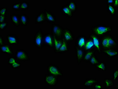 TNRC6A / GW182 Antibody - Immunofluorescence staining of Hela cells with TNRC6A Antibody at 1:333,counter-stained with DAPI. The cells were fixed in 4% formaldehyde, permeabilized using 0.2% Triton X-100 and blocked in 10% normal Goat Serum. The cells were then incubated with the antibody overnight at 4°C.The secondary antibody was Alexa Fluor 488-congugated AffiniPure Goat Anti-Rabbit IgG (H+L).
