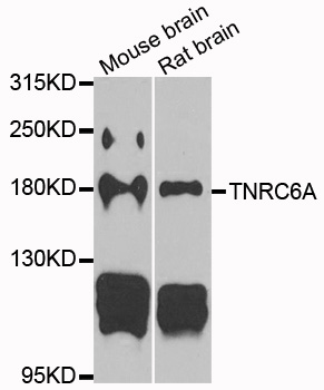 TNRC6A / GW182 Antibody - Western blot analysis of extracts of various cells.