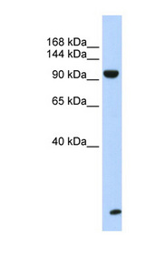 TNRC6B Antibody - TNRC6B antibody Western blot of Fetal Muscle lysate. This image was taken for the unconjugated form of this product. Other forms have not been tested.