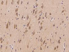 TNRC6B Antibody - Immunochemical staining of human TNRC6B in human brain with rabbit polyclonal antibody at 1:100 dilution, formalin-fixed paraffin embedded sections.