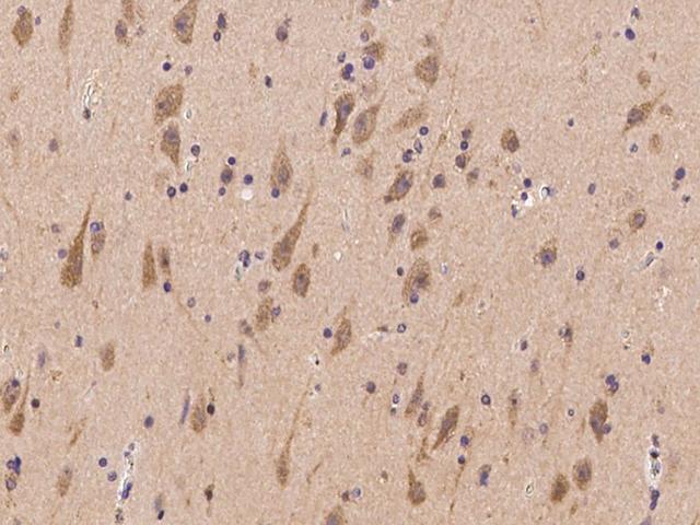 TNRC6B Antibody - Immunochemical staining of human TNRC6B in human brain with rabbit polyclonal antibody at 1:100 dilution, formalin-fixed paraffin embedded sections.