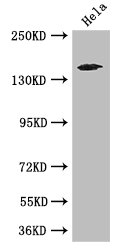 TNRC6C Antibody - Positive WB detected in:Hela whole cell lysate;All lanes: TNRC6C antibody at 3.4ug/ml;Secondary;Goat polyclonal to rabbit IgG at 1/50000 dilution;Predicted band size: 176,180 kDa;Observed band size: 176 kDa;