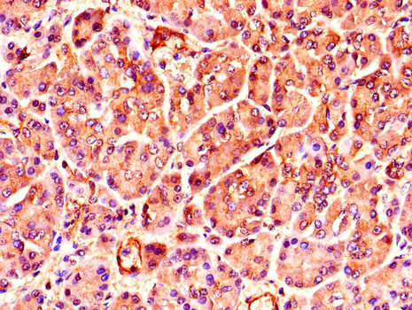 TNRC6C Antibody - Immunohistochemistry of paraffin-embedded human pancreatic tissue using TNRC6C Antibody at dilution of 1:100