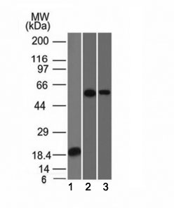 TNRC9 / TOX3 Antibody - Western blot analysis of 1) partial recombinant protein, 2) A549 and 3) A431 stained with TOX-3 antibody (TOX3/1124).  This image was taken for the unmodified form of this product. Other forms have not been tested.