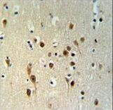 TNRC9 / TOX3 Antibody - TOX3 Antibody IHC of formalin-fixed and paraffin-embedded brain tissue followed by peroxidase-conjugated secondary antibody and DAB staining.