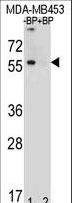 TNRC9 / TOX3 Antibody - Western blot of TOX3 Antibody antibody pre-incubated without(lane 1) and with(lane 2) blocking peptide in MDA-MB453 cell line lysate. TOX3 Antibody (arrow) was detected using the purified antibody.
