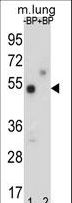 TNRC9 / TOX3 Antibody - Western blot of TOX3 Antibody antibody pre-incubated without(lane 1) and with(lane 2) blocking peptide in mouse lung tissue lysate. TOX3 Antibody (arrow) was detected using the purified antibody.