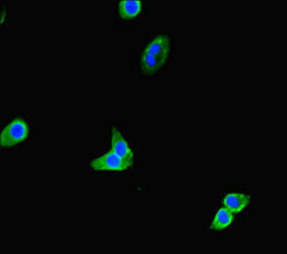 TNRC9 / TOX3 Antibody - Immunofluorescent analysis of HepG-2 cells diluted at 1:100 and Alexa Fluor 488-congugated AffiniPure Goat Anti-Rabbit IgG(H+L)