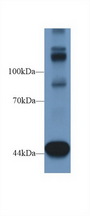TNS1 / Tensin-1 Antibody - Western Blot; Sample: Mouse Heart lysate; Primary Ab: 1µg/ml Rabbit Anti-Human TNS1 Antibody Second Ab: 0.2µg/mL HRP-Linked Caprine Anti-Rabbit IgG Polyclonal Antibody