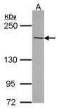 TNS2 / TENC1 Antibody - Sample (30 ug of whole cell lysate). A: Hela. 5% SDS PAGE. TENC1 antibody diluted at 1:1000.