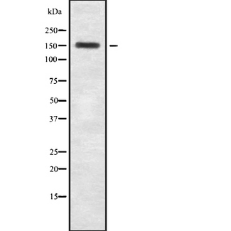 TNS2 / TENC1 Antibody - Western blot analysis of Tensin-2 using MCF-7 whole cells lysates