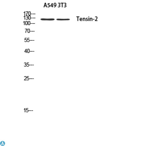TNS2 / TENC1 Antibody - Western Blot (WB) analysis of A549 3T3 using Tensin-2 antibody.