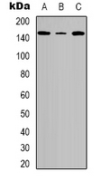TNS2 / TENC1 Antibody - Western blot analysis of Tensin 2 (pY483) expression in A549 (A); HeLa (B); NIH3T3 (C) whole cell lysates.