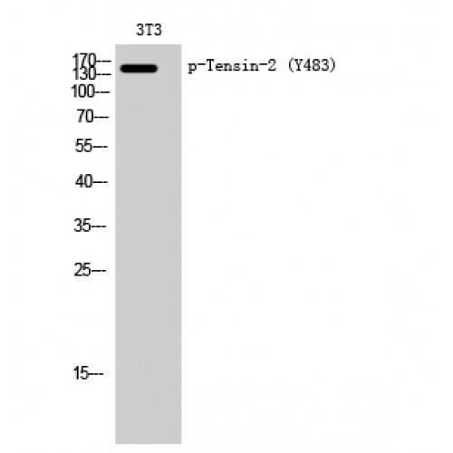 TNS2 / TENC1 Antibody - Western blot of Phospho-Tensin-2 (Y483) antibody