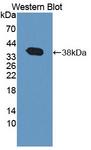 TNS3 / Tensin 3 Antibody - Western blot of TNS3 / Tensin 3 antibody.