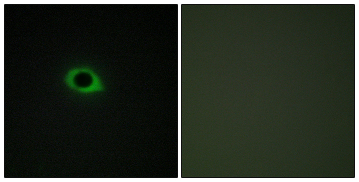 TNS3 / Tensin 3 Antibody - Immunofluorescence analysis of COS7 cells, using TENS3 Antibody. The picture on the right is blocked with the synthesized peptide.