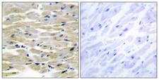 TNS3 / Tensin 3 Antibody - Immunohistochemistry analysis of paraffin-embedded human heart tissue, using TENS3 Antibody. The picture on the right is blocked with the synthesized peptide.