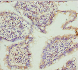 TNS3 / Tensin 3 Antibody - Immunohistochemistry of paraffin-embedded human small intestine tissue at dilution 1:100