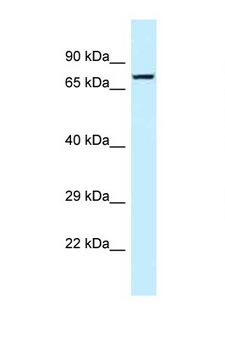 TNS4 Antibody - TNS4 antibody Western blot of MCF7 Cell lysate. Antibody concentration 1 ug/ml.  This image was taken for the unconjugated form of this product. Other forms have not been tested.