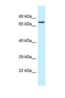 TNS4 Antibody - TNS4 antibody Western blot of MCF7 Cell lysate. Antibody concentration 1 ug/ml.  This image was taken for the unconjugated form of this product. Other forms have not been tested.