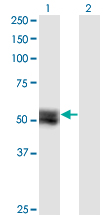 TNS4 Antibody - Western blot of TNS4 expression in transfected 293T cell line by TNS4 monoclonal antibody (M02), clone 1C1.