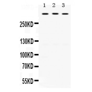 TNXB / Tenascin XB Antibody - TNXB antibody Western blot. All lanes: Anti TNXB at 0.5 ug/ml. Lane 1: MCF- 7 Whole Cell Lysate at 40 ug. Lane 2: SW620 Whole Cell Lysate at 40 ug. Lane 3: HELA Whole Cell Lysate at 40 ug. Predicted band size: 458 kD. Observed band size: 458 kD.